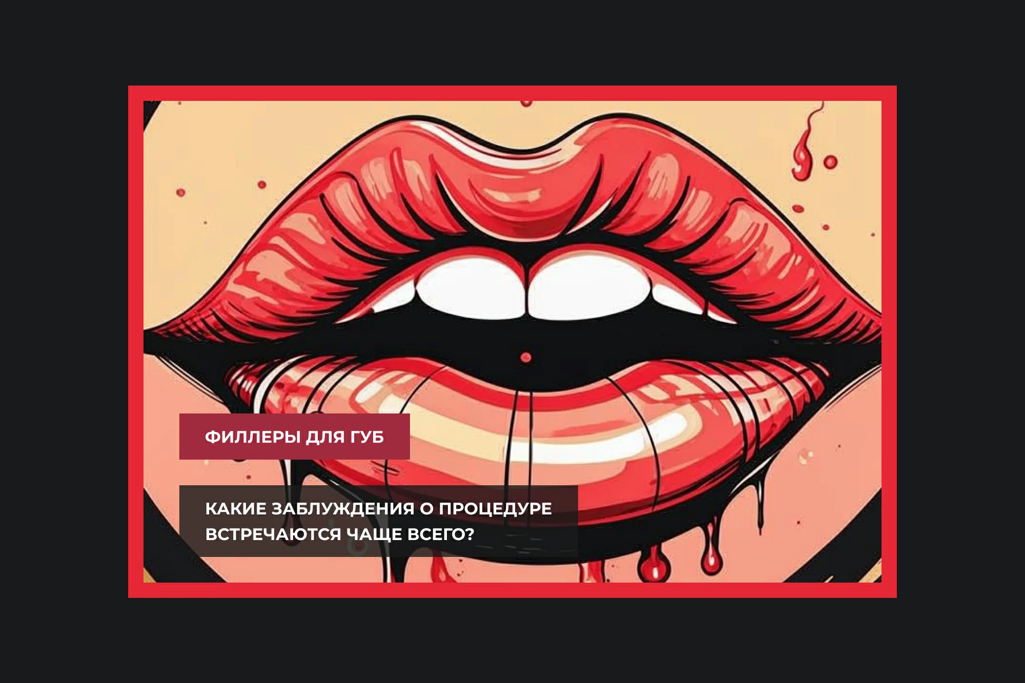 5 популярных мифов о контурной пластике губ