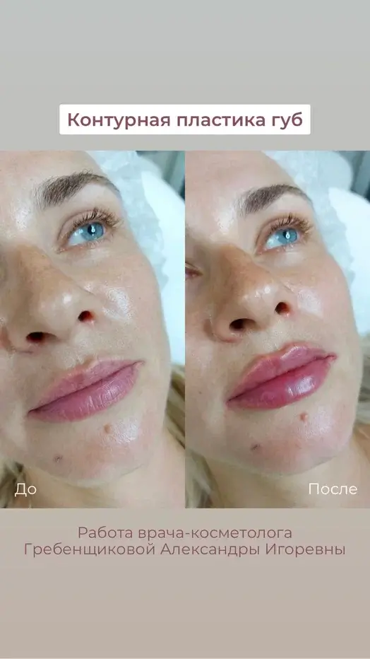 Фото до и после