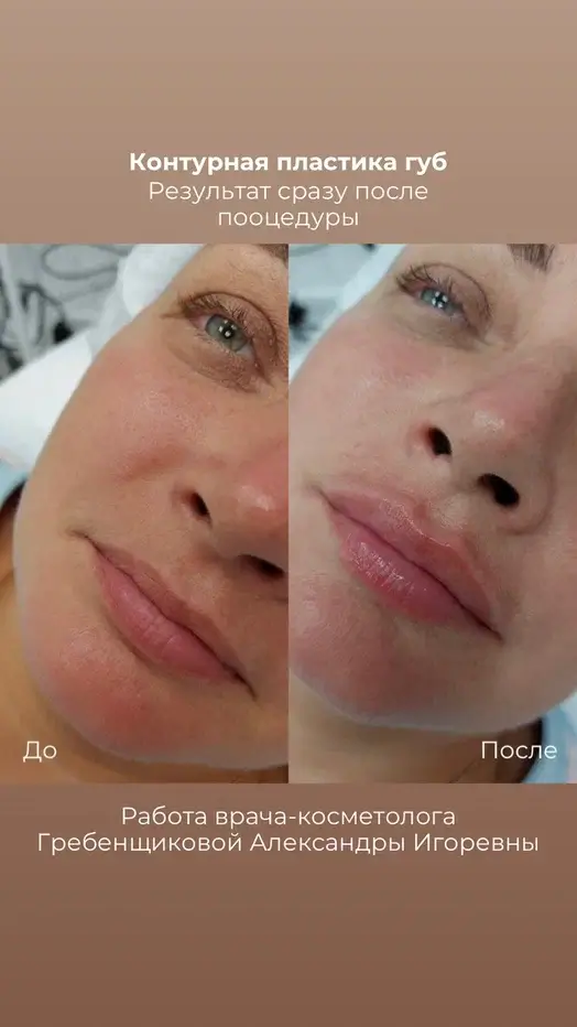 Фото до и после