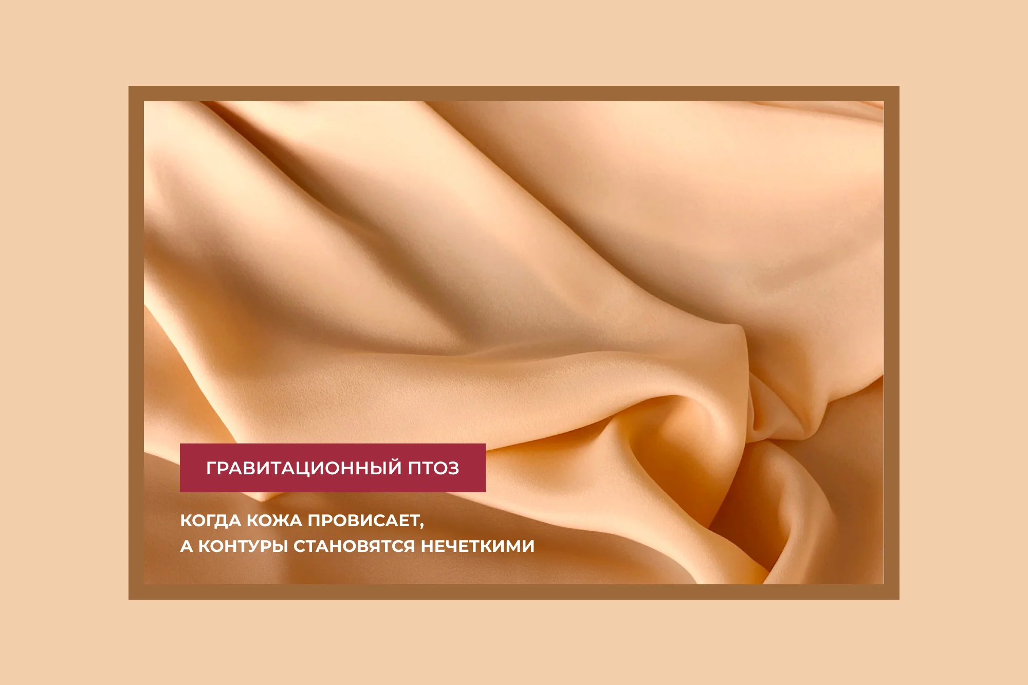 Гравитационный птоз. Что делать, если лицо «поплыло» и контуры стали нечеткими?