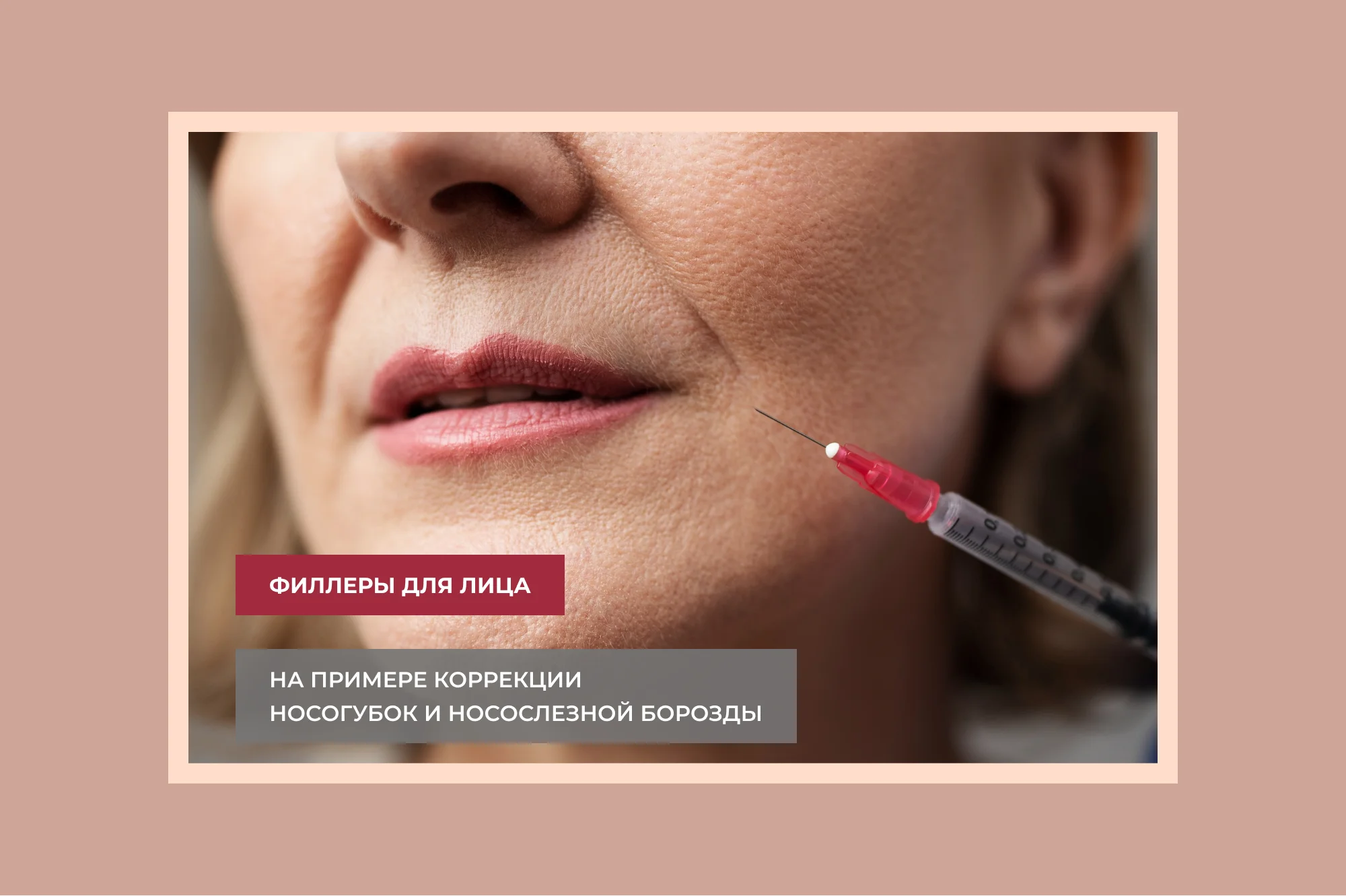 Что такое филлеры и какие проблемы можно решить с их помощью?
