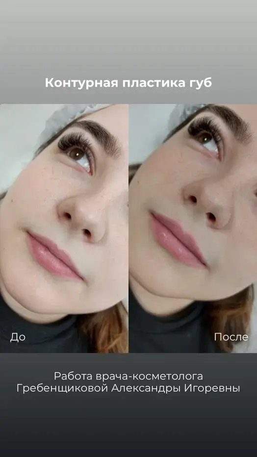 Фото до и после