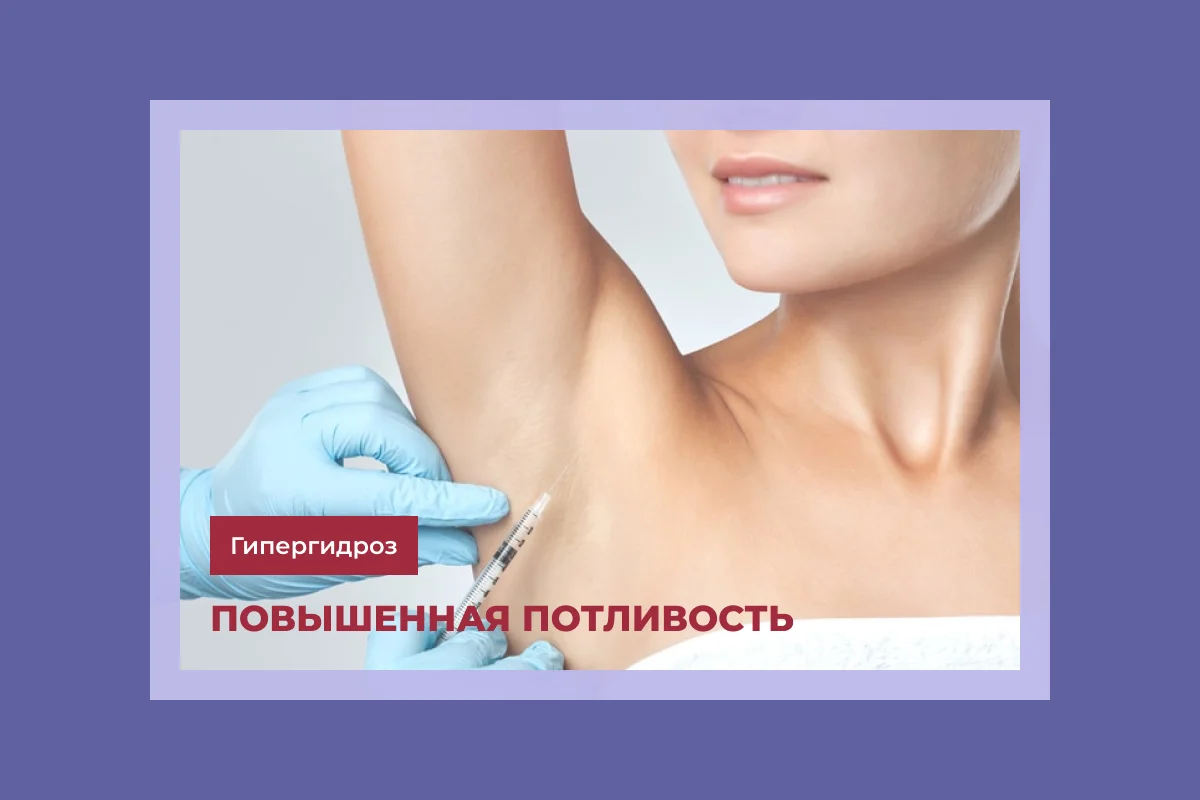 Избыточное потоотделение — Гипергидроз