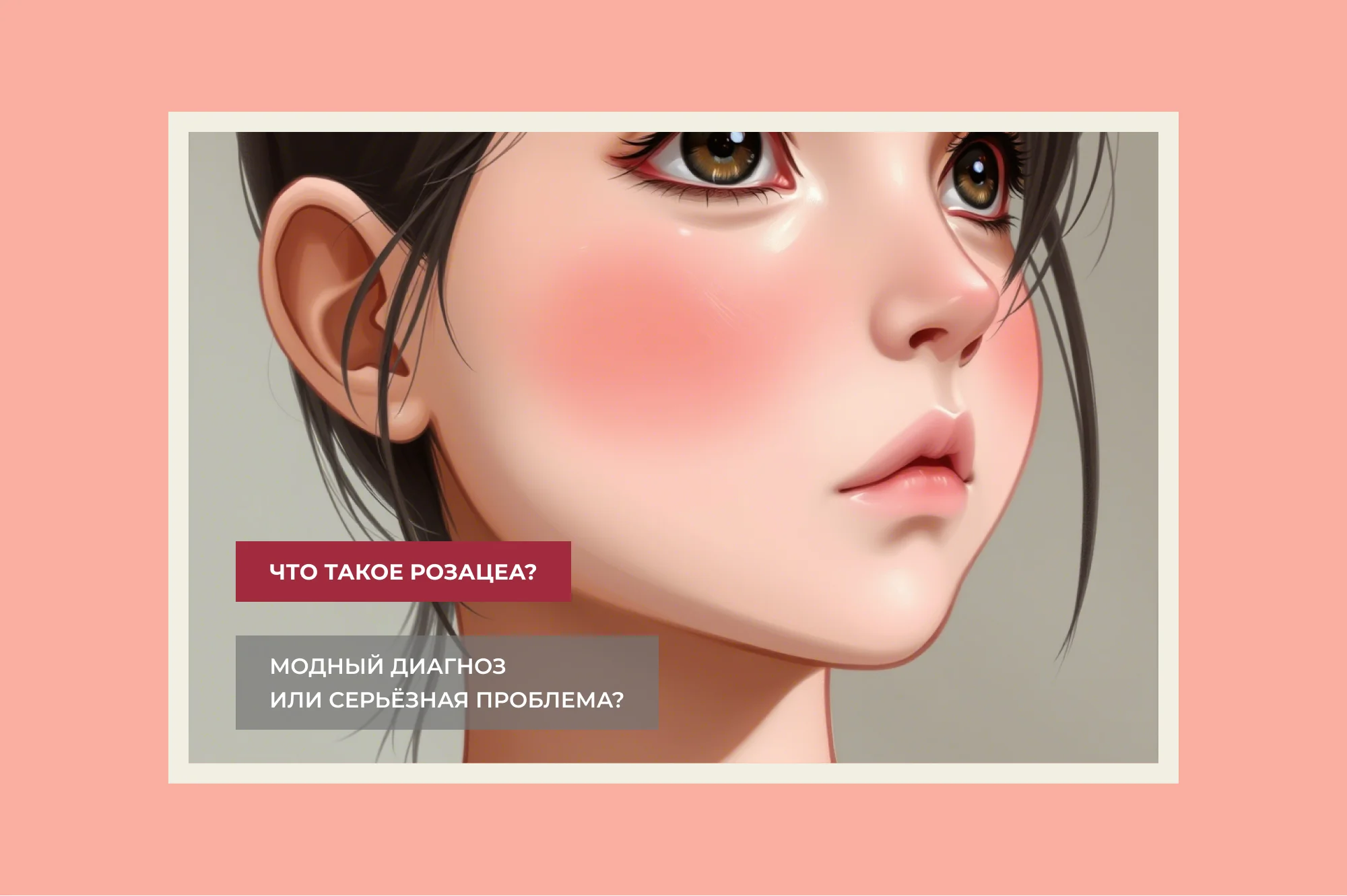 Что такое розацеа кожи?