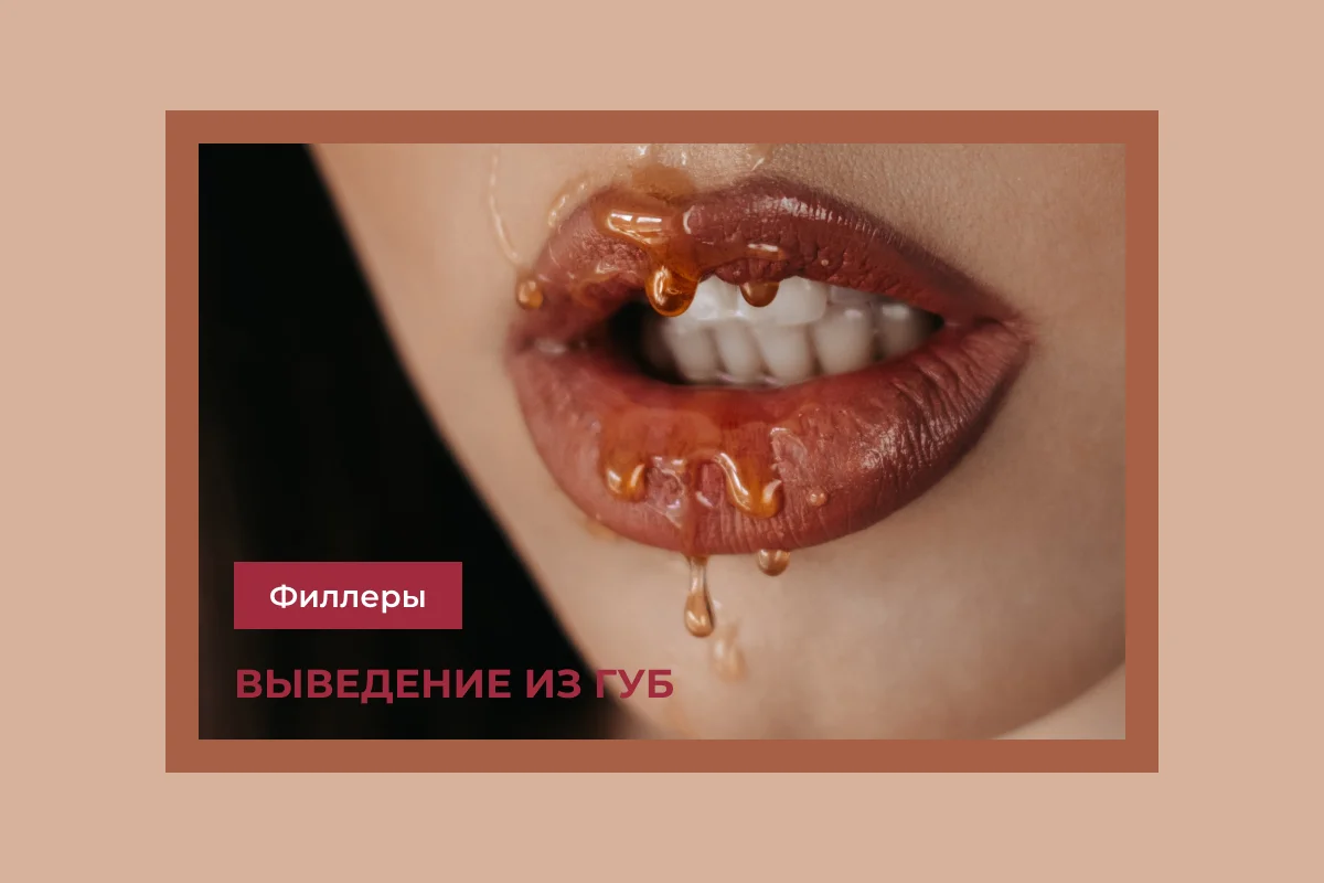 Как выводят филлер из губ
