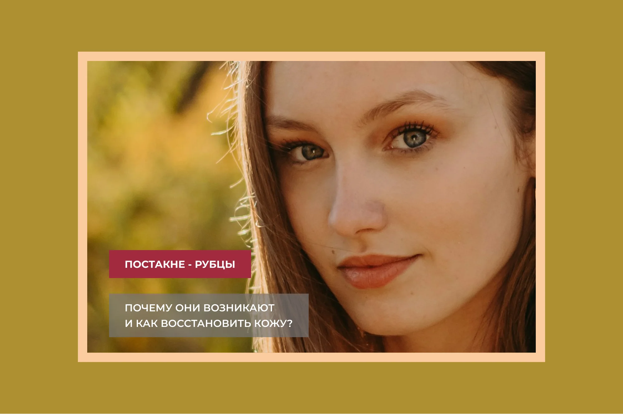 Как избавиться от следов от прыщей?